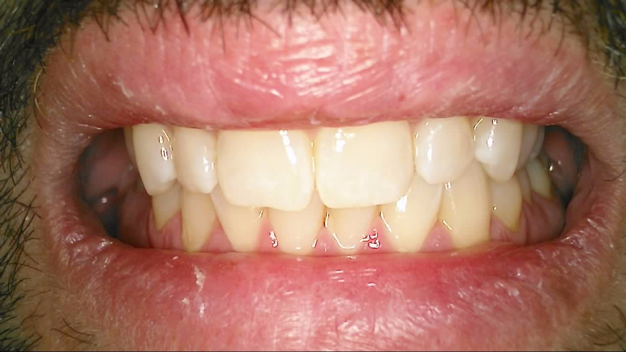 QuickCam Duo Auto Focus Intra and Extra Oral Camera