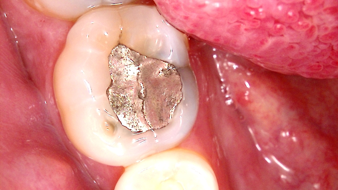 QuickCam Duo Auto Focus Intra and Extra Oral Camera