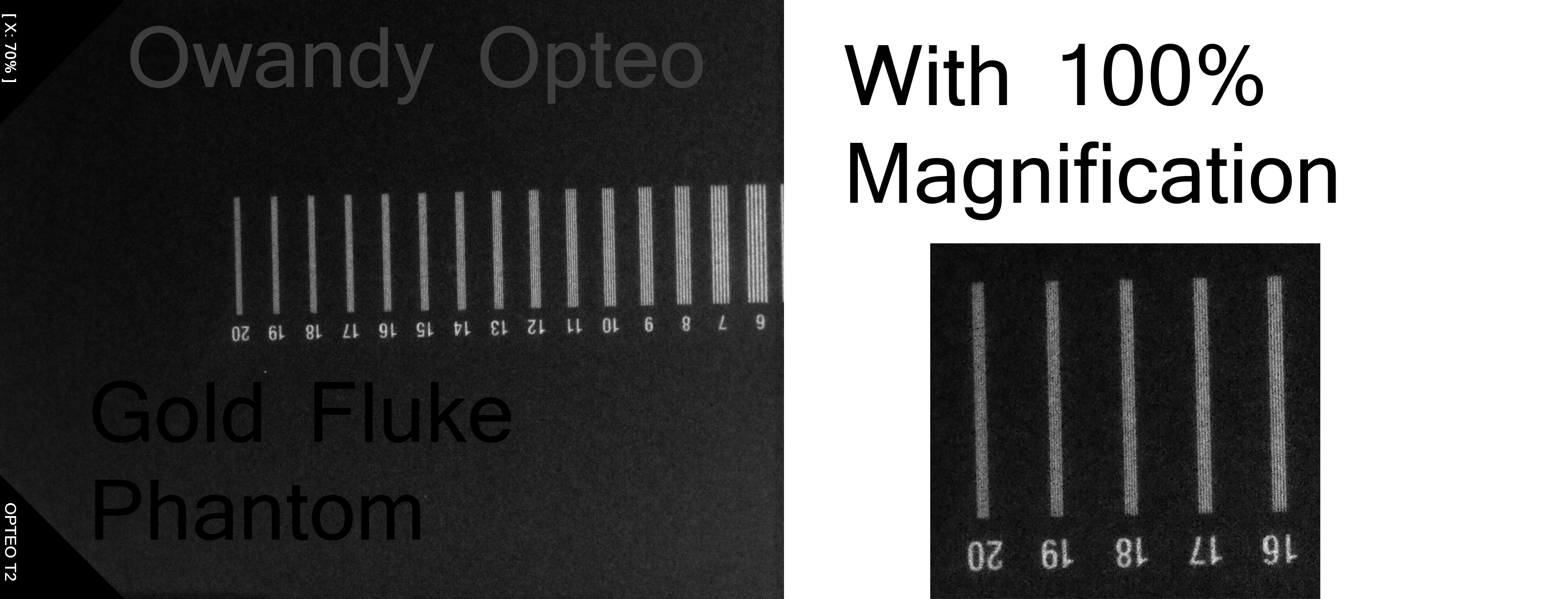 Line Pairs Per Millimeter Phantom Test Platinum, Uniray, Owandy Opteo