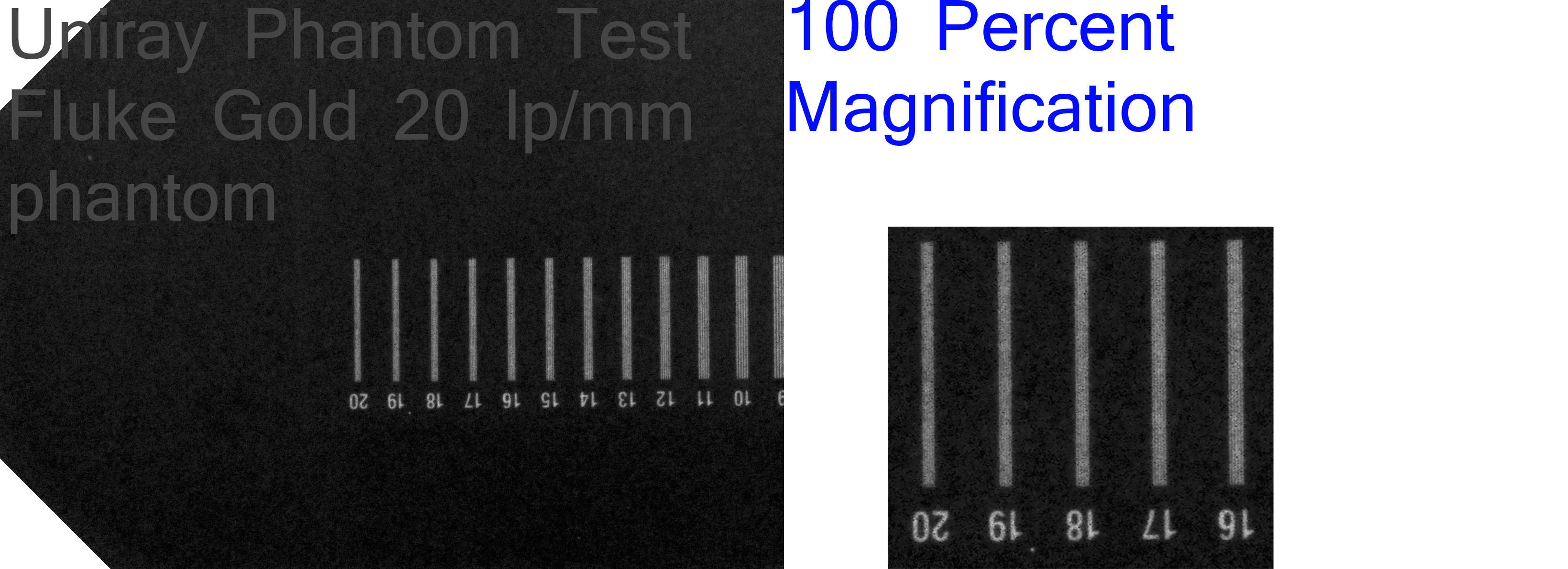 Line Pairs Per Millimeter Phantom Test Platinum, Uniray, Owandy Opteo