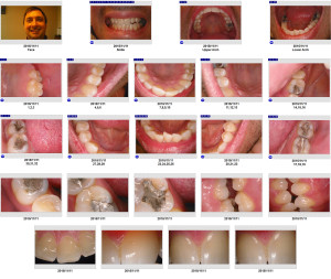 Quickcam Duo Example Images Taken By Sodium Dental